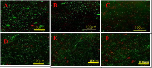Figure 11. Confocal laser scanning microscopy (CLSM) images of E.coli treated with quercetin (A), complex 1 (B) and Complex 2 (C), and S. aureus treated with quercetin (D), complex 1 (E) and complex 2 (F).Note: Viable cells in green colour; dead cells in red colour.