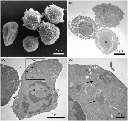 Figure 5. Electron microscopy images of control P3X cells and P3X cells treated with 25 µg/mL. (A) SEM micrographs showing normal and damaged cells after treatment. (B–D) TEM observation did not reveal new alterations with respect to the previous experiments. Cells displayed a high level of modification to the membrane system and cellular inclusions (B) (arrowheads). Multilamellar bodies (arrows) were also observed in the cytoplasm (C, rectangle). (n) nucleus; bars: (A) 5 µm, (B) 5 µm, (C) 5 µm, and (D) 1.25 µm.