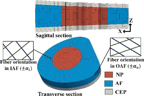 Figure 1. Geometry of C6-C7 IVD.