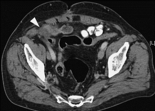 Figure 3.  CT scan at week 37