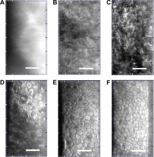 Figure 3 The results of corneal cell density at various parts of the cornea at 9 months after surgery.