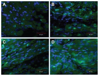 Figure 5 Images of Pax-7 positive nuclei, shown as an overlaid image of 4′,6-diamidino-2-phenylindole-stained nuclei (blue) and Pax-7 nuclei stained with fluorescein isothiocyanate (green), in the cross-section of the breast muscle of a chicken embryo on day 20 of incubation visualized using a confocal microscope. (A) Control, (B) gold nanoparticles, (C) heparan sulfate, and (D) gold nanoparticles and heparan sulfate complex.