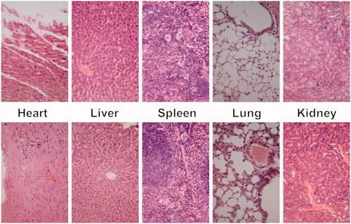 Figure 12. Representative HE stain image of organ histology by Tf-HPAA-GO/DOC/pMMP-9 (top row) and PBS control (bottom row).