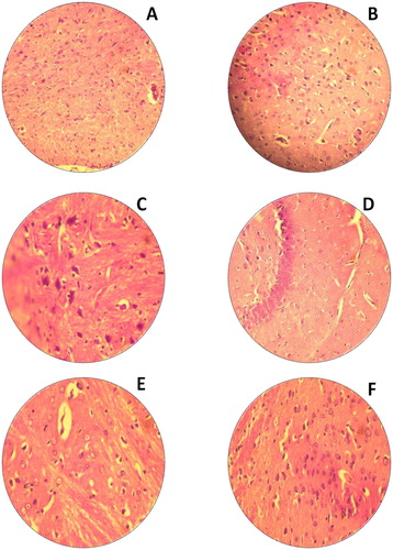 Figure 6. H&E staining of rat brain. (A) Untreated rat for 14th day (−); (B) Untreated rat for 28th day (−); (C) Rats treated with Bio-AgNPs, i/p route for 14th day (−); (D) Rats treated with Bio-AgNPs, i/p route for 28th day (−); (E) Rats treated with Bio-AgNPs, i/v route for 14th day (−); (F) Rats treated with Bio-AgNPs, i/v route for 28th day (−). *where (−) indicates no changes, (+) indicates mild changes, (++) indicates moderate changes, (+++) indicates severe changes.
