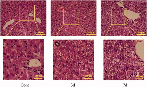 Figure 2. The sections of mice liver before and after isopsoralen-treatment with H&E staining. Cont: control group; 3d: 3d group; 7d: 7d group.
