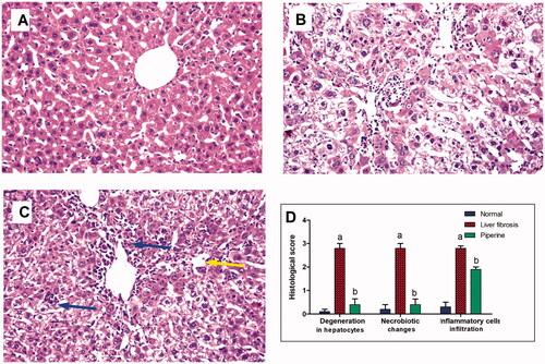 Figure 5. Effect of dasatinib treatment on the histopathological alterations in the liver tissue in mice with thioacetamide-induced liver fibrosis (H&E × 16): (A) control group, (B) liver fibrosis group, (C) dasatinib-treated group, (D) scoring of the histological observations in the hepatic tissue from all groups. Data are presented as mean ± SEM of 6 random non-overlapping fields/section. aSignificant difference from the control group, bsignificant difference from liver fibrosis inducted-group (at p ˂ .05).