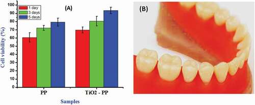 Figure 6. Quantified cell viability (a) of the PEEK/PMMA with and without TiO2 nanoparticles at 1, 3, and 5 days of culture using dental pulp cells and (b) 3D printed prosthesis by using TiO2-incorporated PEEK/PMMA nanocomposite.