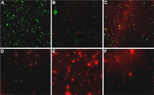 Figure 11 Fluorescence micrographs of Escherichia coli.Notes: (A) Bacteria treated with medium only as a control, (B) bacteria treated with AuNPs, (C) bacteria treated with GlcN-AuNPs, (D) bacteria treated with ultraviolet-irradiated GlcN-AuNPs, (E) bacteria treated with laser-irradiated GlcN-AuNPs, and (F) bacteria treated with standard kanamycin. Green indicates live bacteria and red indicates dead bacteria.Abbreviations: AuNPs, gold nanoparticles; GlcN-AuNPs, glucosamine-functionalized gold nanoparticles.