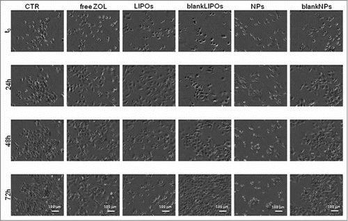 Figure 3. Representative time-lapse images of PC3 cells for a qualitative comparison of ZOL delivery systems. Pictures were taken at 24 h intervals over 72 h. LIPOs and NPs formulation act strongly decreasing cell proliferation rate, if compared with free ZOL. Scale bar, 100 μm.