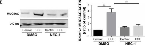 Figure 4 Necroptosis regulates CSE-induced inflammatory response and mucus production in HBE cells.