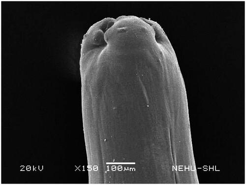 Figure 7. Scanning electron microscopic image of the anterior region of untreated A. perspicillum. The three lips are visible. One of the lips has eye-like amphid.