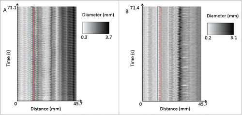 FIGURE 10. A comparison of the spatiotemporal maps of one of the benztropine internal controls (A) and its paired benztropine supratherapeutic trial (B). The control shows more regular contractions throughout the entire length of the organ, whereas the supratherapeutic drug trial shows more irregular and less well-defined contractions. This can be seen for example in the areas highlighted in red, where in the control, the variation in diameter is regular and the amplitude is large, where in comparison the therapeutic trial shows more irregular, lower amplitude contractions.