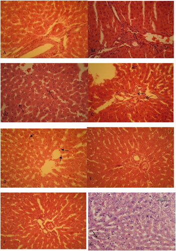 Figure 4. Histopathological studies. (A) LAP group, the portal tract and the hepatocytes in normal condition. (B1) CLP group, neutrophil infiltration in the portal tract (arrows). (B2) CLP group, neutrophil infiltration in the sinusoids which can be seen easily with their dark nuclei (arrows). (C) DDW15 + ML, mild neutrophil infiltration in the portal tract and the parenchyma (thin arrows), H&E, 400*. (D) DDW30 + ML group, there is not any infiltrated neutrophil in the picture. Kupffer cells also could be seen (arrows), H&E, 400*. (E) *DDW15 group, the portal tract and the parenchyma in normal condition. H&E, 400*. (F) *DDW30 group, the portal tract and the parenchyma in normal condition. H&E, 400*. (G) Indomethacin group, a few infiltrated neutrophils (arrows) could be seen in the picture. H&E, 400*. *These data are presented here in order to make a new compression among treatment groups (Fatemi et al. Citation2019).