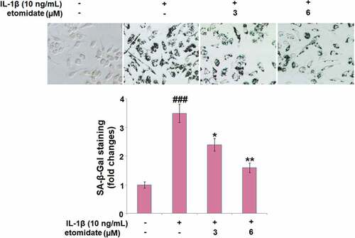 Figure 4. Etomidate mitigates IL-1β-induced cellular senescence. Cells were incubated with IL-1β (10 ng/mL) in the presence or absence of 3 and 6 μM etomidate for 7 days. Cellular senescence was assayed with senescence-associated β- galactosidase (SA-β-Gal) staining (###P < 0.005 vs. vehicle group; *, **P < 0.05, 0.01 vs. IL-1β group).