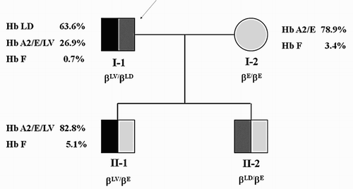 Figure 3. Pedigree of the proband and family. Hb E, [β26(B8)Glu→Lys]; Hb LD, La Desirade [β129(H7)Ala→Val]; Hb LV, Louisville [β42(CD1)Phe→Leu].