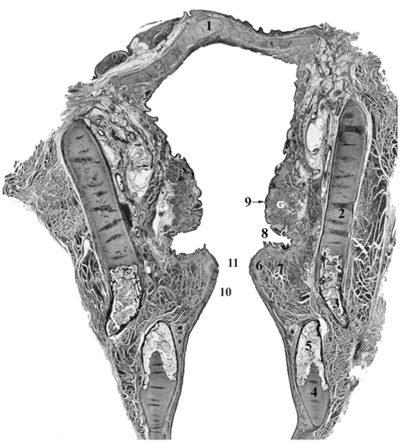 Figure 3 Coronal section of the larynx from 56 year old female illustrating major structural landmarks. Safran-Hematoxylin Stain, 2.5x original magnification. 1 – epiglottis, 2 – unossified thyroid cartilage, 3 – ossified portion of thyroid cartilage, 4 – unossified cricoid cartilage, 5 – ossified portion of cricoid cartilage, 6 – lamina propria of vocal fold, 7 – thyroarytenoid muscle (the major constrictor of vocal fold), 8 – laryngeal ventricle (lined of glandular epithelium), 9 – vestibular fold with G – mucous-serous glands, 10 – conus elasticus, 11 – glottal space.