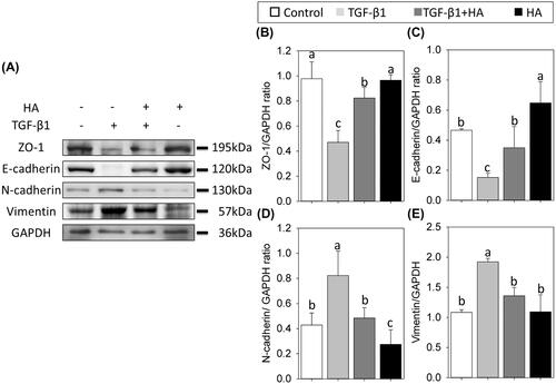 Figure 4. Western blot analyses of ZO-1, E-cadherin, N-cadherin and vimentin (A) in NECs treated with TGF-β1, TGF-β1 plus hyaluronan or hyaluronan. Densitometric analyses are shown (B–E). Results are expressed as the mean ± SD and significant differences are indicated by different letters (p< .05).