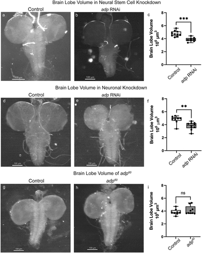 Figure 1. RNAi knockdown of adp but not the presumed adp60 mutant results in significantly reduced brain lobe volume. Stereroscope images of third-instar larval brains just prior to pupation with (A, D) GFP knockdown (VALIUM22-EGFP.ShRNA.1) and (B, E) adp knockdown (TRiP.HMC006600) in neural stem cells (A-C, insc-GAL4) or post-mitotic neurons (D-F, nSyb-GAL4). (C) Brain lobe volume of neural stem cell knockdown of GFP (control) or adp in third-instar larvae; each dot represents one brain lobe (n = 8–10). Knockdown of adp in neural stem cells results in significantly reduced brain lobe volume compared to control (independent t-test, t = 4.932, df = 16, p = 0.0002). (F) Brain lobe volume of post-mitotic neuronal knockdown of GFP (control) or adp in third-instar larvae, each dot represents one brain lobe (n = 9–10). Knockdown of adp in post-mitotic neurons results in significantly reduced brain lobe volume compared to control (independent t-test, t = 3.694, df = 17, p = 0.0018). Stereoscope images of third-instar larval brains just prior to pupation of (G) Oregon-R and (H) the presumed adp60 fly stocks. (I) Brain lobe volume of Oregon-R (control) or adp60 third-instar larvae, each dot represents one brain lobe (n = 8–9). The presumed adp60 mutant does not differ in brain lobe volume compared to an Oregon-R control (independent t-test, t = 0.9658, df = 15, p = 0.3495). Sequencing of the presumed adp60 stock showed no mutation in the adp gene.
