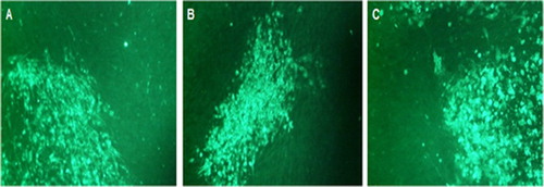 Figure 2. Photographs of HVT-NDV-ILT plaques stained with antibodies specific to the three inserted gene products. (A) HVT-NDV-ILT plaque stained with anti-ILT gD monoclonal antibody, MAB 6, followed by a FITC labelled goat anti-mouse IgG. (B) HVT-NDV-ILT plaque stained with a rabbit anti-ILT gI polyclonal antibody followed by a FITC labelled goat anti-rabbit IgG. (C) HVT-NDV-ILT plaque stained with an anti-NDV-F monoclonal antibody, 57NDV, followed by a FITC labelled goat anti-mouse IgG.