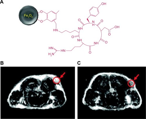 Figure 2 Schematic illustration of the coupling of cRGD peptide to the SPIONs.Notes: (A) MRI cross-section image of the U87MG tumors implanted in mice; (B) without the nanoparticles; and (C) with the injection of 300 μg of cRGD-SPIONs. Reprinted with permission from Ho D, Sun X, Sun S. Monodisperse magnetic nanoparticles for thera nostic applications. Acc Chem Res. 2011;44:875–882.Citation60 Copyright 2011 American Chemical Society.Abbreviations: cRGD, cyclic arginine-glycine-aspartic acid; SPIONs, superparamagnetic iron oxide nanoparticles; MRI, magnetic resonance imaging.