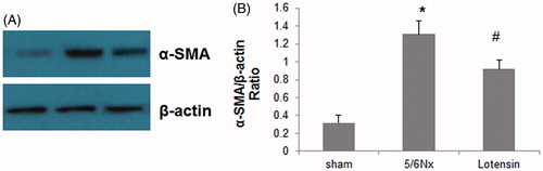 Figure 5. Effect of lotensin on α-SMA expression in renal tissues. (A) Western blot analysis of α-SMA expression in renal tissues; (B) Quantification of α-SMA protein expression by normalization to β-actin; *p < .05 vs. the sham group; #p < 0.05 vs. the 5/6 Nx group (n = 10).