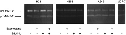 Figure 5. Effect of exemestane and erlotinib on MMP-9 and MMP-2 secretion by H23, H358 and A549 cells. This picture is a representative gel of three independent experiments.
