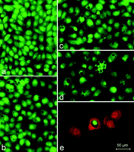 Figure 4. A complete monolayer of HeLa cells with a pale green nuclear fluorescence, bright yellow–green nucleoli as well as considerably more dull green fluorescence of the cytoplasm. (a) The cytoplasm includes focal perinuclear lysosomal accumulations with granular bright orange–red fluorescence. (b) HeLa cells 72 h following the treatment with 200 μg/mL UDCA. (c) 200 μg/mL Ni‒UDCA. (d) 200 μg/mL Cu‒UDCA. (e) 200 μg/mL Zn‒UDCA. Foamy vacuolation of the cytoplasm (b, c and d). Significant cell losses as well as intact and apoptotic dead cells in the (e) treatment. Acridine orange‑-propidium iodide staining.