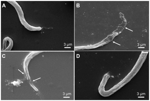 Figure 3 Scanning electron micrographs of (A) untreated control parasite in Roswell Park Memorial Institute medium; (B) microfilariae treated with staurosporine (0.5 μM); (C) microfilariae treated with silver nanoparticles (50 μM), and (D) microfilariae treated with gold nanoparticles (50 μM).Note: Data are representative of three different experiments.