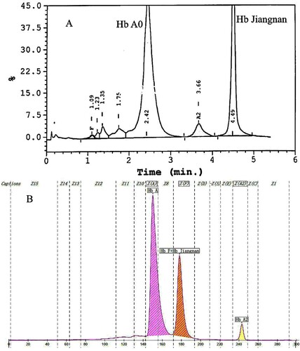 Figure 1. Hb analysis of the proband with Hb Jiangnan by HPLC and CE. HPLC showed an abnormal peak at retention time 4.49 min(A). CE demonstrated a high Hb X level (31.8%) in the Hb F Zone which were actually the sum of Hb X + Hb F(B).
