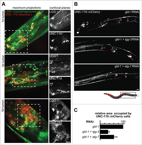 Figure 4. Inhibition of autophagy impairs neuronal differentiation within germline tumors. (A) LGG-1-expressing cells in germline tumors are neurons that coexpress UNC-119. Left panels: Maximum projections of merged z-planes of gld-1 RNAi gonads at d 1, 3 and 5 of adulthood. Right panels: Confocal planes showing LGG-1 (top) and UNC-119 (bottom). Scale bar: 20 μm. (B) UNC-119::mCherry expression in the gonad of gld-1, gld-1+lgg-3 and gld-1+atg-7 RNAi-treated animals (d 1.5 of adulthood). Representative gonad arm reconstructed from maximum projections. Asterisks mark neuronal cells in germline tumors. Top: The region reconstructed is depicted in the schema (boxed area). Scale bar: 20 μm. (C) Area occupied by UNC-119 expressing cells per gonad arm normalized by gld-1 RNAi-treated animals. Qualitative scoring of the gonadal area occupied by UNC-119 expressing cells was performed blindly using maximum z-projections covering whole gonad arms (d 1.5 to 2.5 of adulthood. Data represent mean ± SEM of 3 independent experiments, n = 3 to 6 (6 to 12 gonad arms), per experiment.