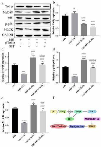 Figure 6. SST inhibited MyD88/NF-κB/MLCK signaling in the rat intestine by upregulating Tollip. (a) Western blotting results of Tollip/MyD88/NF-κB/MLCK signaling. (b-e) The relative protein levels measured by ImageJ software. (f) Summary of this study. I/RI, intestinal I/R injury group; I/RI/SST, I/RI with SST pretreatment; I/RI/siTollip, I/RI with siTollip injection; I/RI/SST/siTollip, I/RI with SST pretreatment and siTollip injection. n = 5 per group. One‑way ANOVA followed by Bonferroni post hoc test was used to compare the differences among different groups, ‘ns’ indicated no significance. nsP>0.05, *P < 0.05, ***P < 0.001, ****P < 0.0001 vs. I/RI group; ####P < 0.0001 vs. I/RI/SST group; @@P < 0.01, @@@P < 0.001, @@@@P < 0.0001 vs. I/RI/siTollip group.