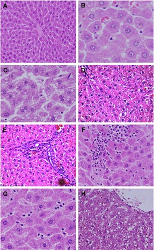 Figure 5 Microphotograph sections of the liver of control rats (A and B) and rats subjected to 50 injections of 10-nm SDNPs (C–H), stained by H&E.Notes: (A) In control rats, the hepatic architecture demonstrates intact hepatic strands radiating outward from a central vein. (B) In control rats, hepatocytes display eosinophilic cytoplasm separated by vascular channels. The round nuclei dispersing smooth chromatin are shown. (C) Hydropic degeneration demonstrating swelling and cytoplasmic vacuolization. (D) Karyopyknosis showing nuclei shrinkage and chromatin condensation. (E) Infiltration of inflammatory cells demonstrating aggregation of inflammatory cells in the hepatic portal space. (F) Infiltration of lobular inflammatory cells (mainly lymphocytes) in the lobular hepatic strands. (G) Hyperplasia of Kupffer cells showing enlargement and hypertrophy of these defense cells. (H) Sinusoidal dilatation exhibiting widening of the capillaries lining the hepatic strands.Abbreviations: H&E, with hematoxylin and eosin; SDNPs, silicon dioxide nanoparticles.