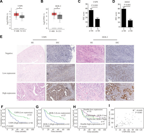 Figure 1 The expression of USP8 and HER-3 and the association with prognosis in gastric cancer patients (A) As analyzed by gene expression profiling interactive analysis (GEPIA), the USP8 expression level in tumor (T) tissues was significantly higher than nontumor (N) tissues. *P < 0.05. (B) Analyzed by GEPIA, the HER-3 expression level in tumor (T) tissues was significantly higher than nontumor (N) tissues. *P < 0.05. (C) Analyzed by immunohistochemical staining (IHC), the USP8 expression level in tumor (T) tissues was significantly higher than nontumor (N) tissues. (D) Analyzed by IHC, the HER-3 expression level in tumor (T) tissues was significantly higher than nontumor (N) tissues. (E) The expressions of USP8 and HER-3 in gastric cancer tissues were evaluated by IHC and hematoxylin-eosin staining (HE, scale bars, 300 μm. Kaplan-Meier survival analysis of overall survival in all patients according to USP8 (F), HER-3 (G) and USP8/HER-3 (H) expression. The Log rank test was used to calculate P values. (I) Linear regression analysis was used to examine the correlation between USP8 and HER-3 IHC scores levels. n = 88.