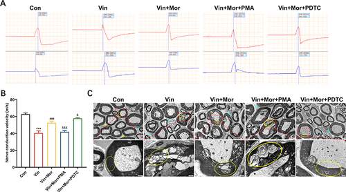 Figure 7 Morin alleviates vincristine-induced nerve injury by regulating NF-κB. (A and B) Changes in sciatic nerve conduction velocity in each group. n=6 rats for each group. Data were shown as mean ± SD. Upper and down panels represented the action potentials recorded at the near-end and far-end of the sciatic nerve, respectively. ***p < 0.001 compared with control group, ###p < 0.001 compared with vincristine group, &p < 0.05 and &&&p < 0.001 compared with vincristine+morin group. (C) Representative images of rat sciatic nerve transmission electron microscope (yellow ↑, ○: myelin sheath, cyan ↑: Schwann cells).