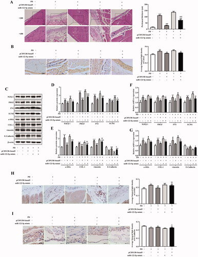 Figure 6. MiR-122-5p aggravated peritoneal fibrosis and EMT progression by targeting Smad5 in vivo. (A) Hematoxylin-eosin (HE) staining of the peritoneal membrane. (B) Immunohistochemical of Col1α1 expression. (C-G) Western blot shows the expression of TGF-β1, PDGF, FN1, ECM1, α-SMA, COL-1, COL-1, vimentin, and E-Cadherin in peritoneum of different groups. (H) Immunohistochemical of α-SMA expression. (I) Immunohistochemical of E-Cadherin expression.**p<.01, ***p<.001 versus the control (Con) group. #p<.05, ##p<.01, ###p<.001 versus the PD group. &p<.05, &&p<.01, &&&p<.001 versus pCD513B-Smad5 treatment group. $p<.05, $$p<.01, $$$p<.001 versus miR-122-5p mimic treatment group. n = 8 (Con group), n = 7 (PD group), n = 6 (PD + pCD513B-Smad5 group), n = 6 (PD + miR-122-5p mimic group), and n = 6 (PD + pCD513B-Smad5 + miR-122-5p mimic group).