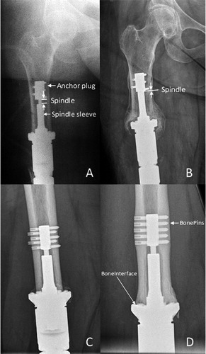 Figure 3. Radiographic parameters used to construct the fast and frugal tree model.