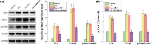 Figure 2. The results for the protein and RNA expression levels of the GF-β1/Smad3 pathway. (A) The results for the protein expression levels detected by western blot. (B) The results for the RNA expression levels detected by RT-qPCR. *p < 0.05, compared to the Control group. #p < 0.05, compared to the Tac and Tac + si-NC groups.