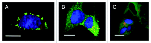 Figure 2. Laser scanning confocal microscopy of DISC1 aggregates in neuroblastoma cells. A. Mouse neuroblastoma cells (CAD cells) permanently transfected with monomeric red fluorescent protein (mRFP) transiently transfected with untagged, full length DISC1, stained with α-DISC1 mAB 14F2Citation69 and a secondary FITC-labeled antibody. Bar 10 μm. B. Human SHSY5Y cells permanently transfected with green fluorescent protein fused to human DISC1 (598–854), incubated with recombinant human DISC1 (598–854) expressed and purified from E. coli and labeled with Dylight® (red) as described by Ottis et al.Citation69 Bar 10 μm C. Human SHSY5Y cells permanently transfected with green fluorescent protein fused to human DISC1 (598–854), and incubated with synthetic α-synuclein labeled with Dylight® (red) as described by Ottis et al.Citation69 Bar 10 μm.