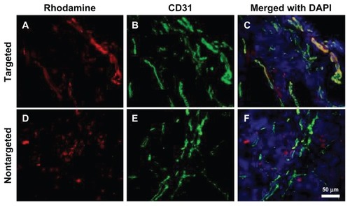Figure 8 Fluorescence microscopy images of tumor tissues. (A–C) Bt-ML colocalizes with the angiogenic vasculature from the tumor periphery; (D–F) ML is seen beyond the vasculature.Notes: Liposomal fluorescence from rhodamine (red) is shown in the left panel. Endothelium stained using an antimouse CD31 antibody (green) is shown in the middle panel. Color overlays with nuclei counterstained DAPI (blue) are shown in the right panel.Abbreviations: DAPI, 4,6′-diamidino-2-phenylindole; Bt-ML, biotinylated magnetoliposomes.