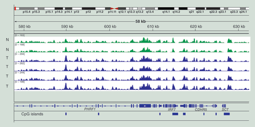 Figure 2.  Example of the reliability of MIRA-seq profiles.Data are for two samples of normal melanocytes from different individuals (N, green, at the top) and four melanoma tumors (T, blue, at the bottom). The data are displayed in the Integrative Genomics Viewer. An area of the short arm of chromosome 11 near the end of the chromosome is shown.