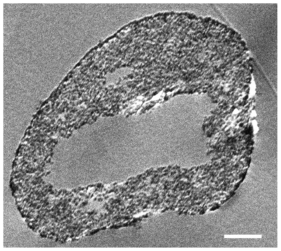 Figure 4 TEM image of a thin section (40 nm) of a resin-embedded microparticle. Significantly, a hollow space in the center of the donut-like microparticle is observable. The microparticles are surrounded by a darker more compact edge.Note: Scale bar = 1 μm.Abbreviation: TEM, transmission electron microscopy.