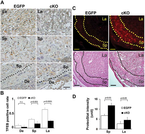 Figure 9. Evidence for reduced TFEB expression and enhanced intrinsic protein aggregation in trophoblast-specific atg7 cKO placentas. (A, B) TFEB staining was performed in placenta-specific atg7 knockout mice (cKO) and control mice (EGFP) (A). TFEB-positive cell rate in the placentas from cKO and EGFP were calculated and statistically analyzed (B). La: labyrinth layer, Sp: spongiotrophoblast layer, De: decidua. Arrows indicated TFEB-positive trophoblasts. (C, D) Protein aggregates in the labyrinth layer (La) and spongiotrophoblast layer (Sp) in the placentas from atg7 cKO and EGFP control mice were identified by ProteoStat staining (C). H&E staining showed the structure of mouse placental tissue. The intensity of ProteoStat signal in the placentas was compared between EGFP control and atg7 cKO as shown in D. Data are expressed as mean ± SEM and analyzed by a Student t-test (n = 4). Bar: 50 µm.