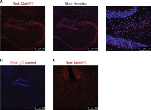Figure 5 MetAP2 expression in neurons in the brain obtained from lean mice.