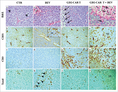 Figure 2. Histologic and immunohistochemical features of tumors developed after orthotopic engraftment of HTLA-230 NB in Scid/Beige mice treated with BEV, GD2-CAR T cells, or GD2-CAR cells+BEV. H&E staining of tumors developed in untreated (CTR) mice (a) and in mice receiving 5 mg/Kg BEV (e), GD2-CAR T cells (i) or GD2-CAR T cells+BEV (m). Arrowheads in a: mitotic figures; arrows in i and m: lymphocyte infiltration. CD31 and CD3 immunostaining of tumors developed in untreated mice (b,c), BEV- (f,g), GD2-CAR T cell- (j,k) or GD2-CAR T cells+BEV- (n,o) treated mice. Tunel assay in tumors developed in untreated mice (d) and in mice treated with BEV (h), GD2-CAR T cells (l) or GD2-CAR T cells+BEV(p). Arrowheads in h: apoptotic figures along the vascular endothelial walls. NE: necrosis. (Magnification a-l: X400; m: X630; n-p: X400)