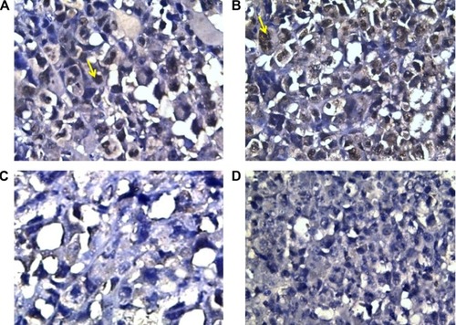 Figure 3 Ki-67 nuclear expression in different groups.