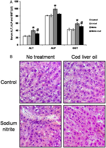 Figure 1. Effect of sodium nitrite (Nitrite, 80 mg/kg/day) alone and its combination with cod liver oil (Cod, 5 ml/kg/day) for 12 weeks on serum alanine aminotransferase (ALT), alkaline phosphatase (ALP) and gamma glutamyl transferase (GGT) (A) as well as liver sections stained with H/E (B). *Significant difference as compared with the rest of the groups at P < 0.05. #Significant difference as compared with the control group at P < 0.05.
