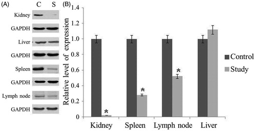 Figure 2. The expression levels of Blimp-1 protein in the kidney, liver, lymph nodes and spleen in the experimental groups. (A) 15-week-old MRL-Fas(lpr) mice received an intravenous tail vein injection of lentivirus vector. After 21 days, the mice were sacrificed, and the Blimp-1 expression in kidney, spleen, lymph node and liver was analyzed by Western blot. (B) Blimp-1 expression was analyzed by semi-quantitative Western blot by using GAPDH for normalization. *Compared with controls, p < 0.05. C: control group, S: study group. The results are representative of three individual experiments.