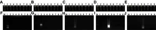 Figure 3 Specificity of the loop-mediated isothermal amplification (LAMP) assays. (A–E) Visual detection of the LAMP amplification products with SYBR Green I. (F–J) Agarose gel electrophoresis of the LAMP products. Lane M: Trans 2K plus II DNA marker; Lanes 1–5: mcr-1 to mcr-5 genes; Lane 6: blaKPC-2; Lane 7: blaNDM-1; Lane 8: blaCTX-M-9; Lane 9: negative (water).