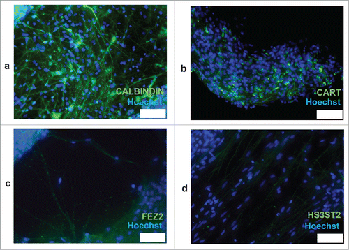 Figure 6. Immunostaining of iPSC-derived neurons with CALBINDIN (a), CART (b), FEZ2 (c), and HS3ST2 (d). Scale bars are 75 μm.