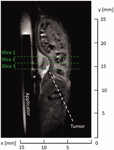 Figure 5. T2-turboRare anatomical image with highlighted positions of axial slices for real-time temperature monitoring.